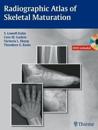 Radiographic Atlas of Skeletal Maturation