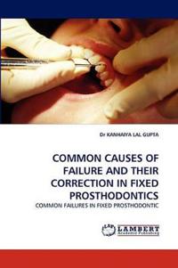 Common Causes of Failure and Their Correction in Fixed Prosthodontics