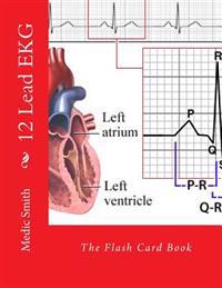 12 Lead EKG: The Flash Card Book