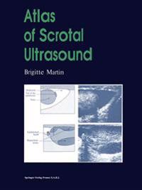 Atlas of Scrotal Ultrasound