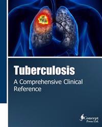 Tuberculosis: A Comprehensive Clinical Reference