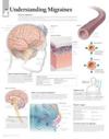 Understanding Migraines Paper Poster