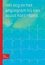 Het ECG En Het Angiogram Bij Een Acuut Hartinfarct