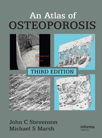 Atlas of Osteoporosis, Third Edition
