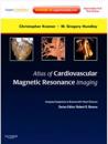 Atlas of Cardiovascular Magnetic Resonance Imaging: Expert Consult - Online and Print