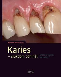 Karies : - sjukdom och hål