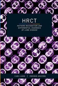 HRCT- Pattern Recognition and Differential Diagnosis of Lung Disease