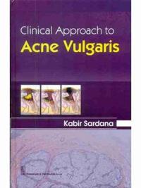 CLINICAL APPROACH TO ACNE VULGARIS