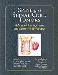 Spine and Spinal Cord Tumors