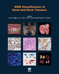 Who Classification of Head and Neck Tumours
