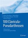 100 Clavicula-Pseudarthrosen