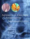 Arthritis in Children and Adolescents
