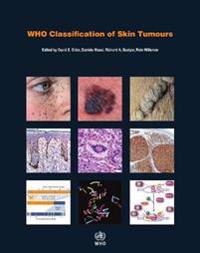 WHO classification of skin tumours