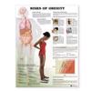 Risks of Obesity Anatomical Chart