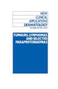 Tumours, Lymphomas and Selected Paraproteinaemias