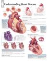 Understanding Heart Disease Paper Poster