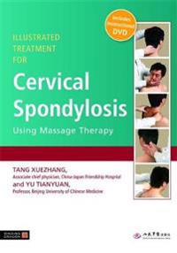 Illustrated Treatment for Cervical Spondylosis Using Massage