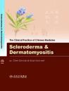 Scleroderma and Dermatomyositis