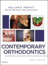 Contemporary Orthodontics - E-Book