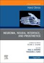 Neuroma, Neural interface, and Prosthetics, An Issue of Hand Clinics