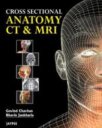 Cross Sectional Anatomy CT & MRI