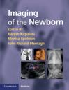 Imaging of the Newborn
