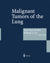 Malignant Tumors of the Lung