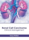 Renal Cell Carcinoma: Clinical Management