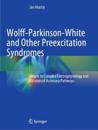 Wolff-Parkinson-White and Other Preexcitation Syndromes