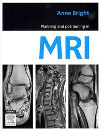 Planning and Positioning in MRI