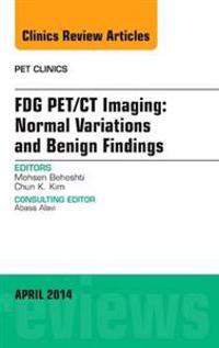 Fdg Pet/Ct Imaging