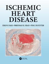 Ischemic Heart Disease