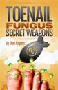 Toenail Fungus Secret Weapons: Uncover Over 14 Toenail Fungus Treatments That You Can Combine to Clear Your Toe Nails in Under 45 Days!